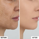 Belly and Skin Tightening Cream
